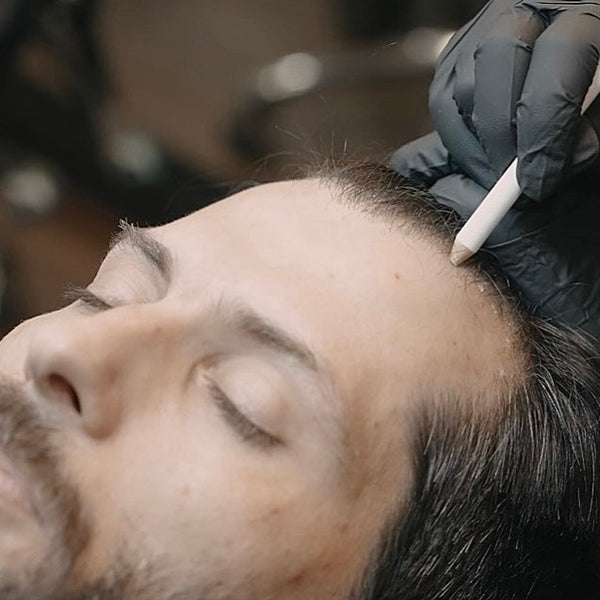 Scalp Micropigmentation Live Training